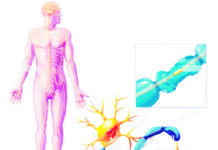 ಏನಿದು ಜಿಬಿ ಸಿಂಡ್ರೋಮ್?